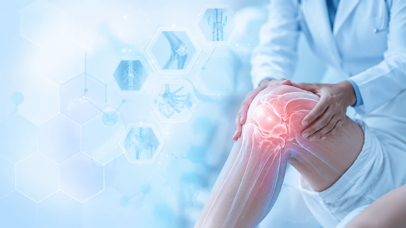 Consulta de reumatología en Clínica Vásquez Tingo María